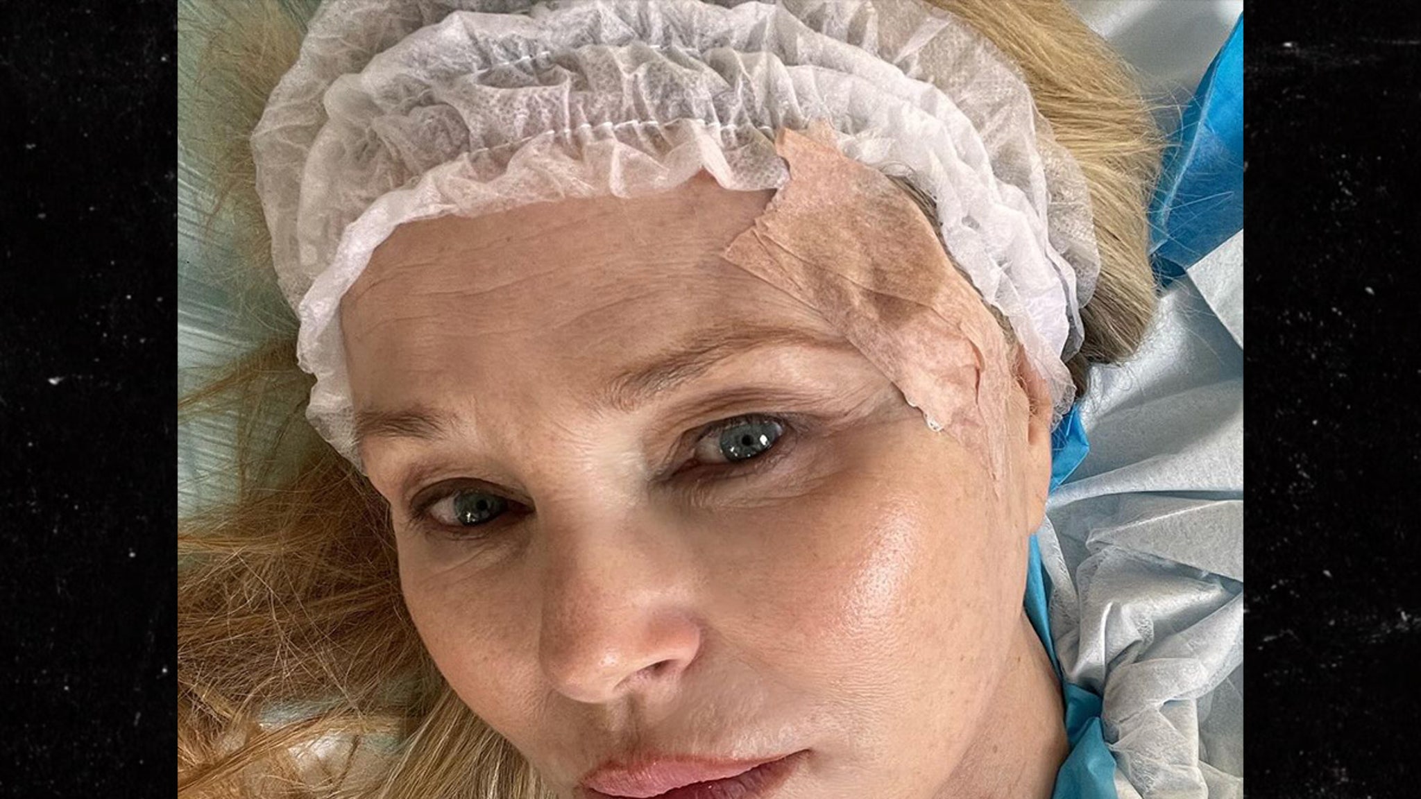 You are currently viewing Christie Brinkley revela su diagnóstico de cáncer de piel y comparte fotos de la operación