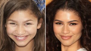 Read more about the article Zendaya — Good Genes Or Good Docs?!