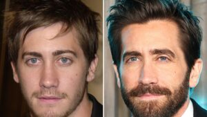 Read more about the article Jake Gyllenhaal — Good Genes Or Good Docs?!